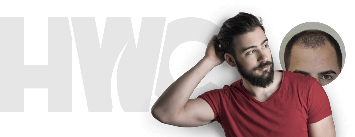 Best hair loss treatments for men and women in Kerala - Hair Wellness Clinic
