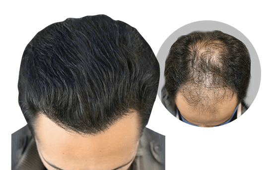 Hair Wellness Clinic Surgical Hair Restoration hair falling solution