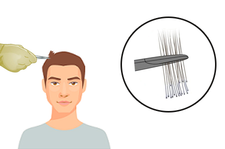 Hair Wellness Clinic's Hair Loss Test