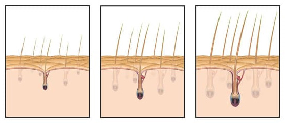 hair wellness clinic's scalp micropigmentation